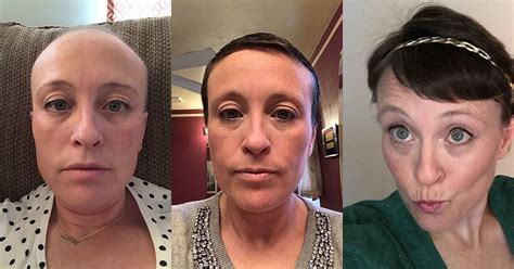 cheap hair cuts for women that are having cancer treatment
